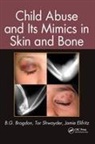B. G. Brogdon, B. G. (Usa (University of South Alabama) Brogdon, B. G. Shwayder Brogdon, Brogdon B. G., Jamie Elifritz, Elifritz Jamie... - Child Abuse and Its Mimics in Skin and Bone