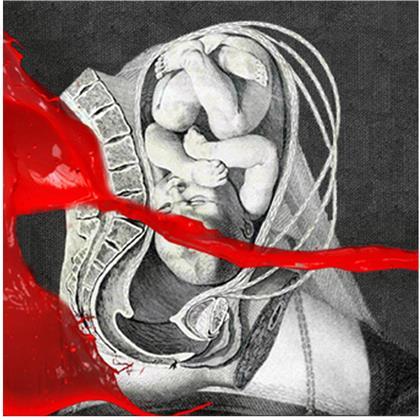 Iamx (Sneaker Pimps) - Unified Field (Limited Edition, CD + 2 LPs)