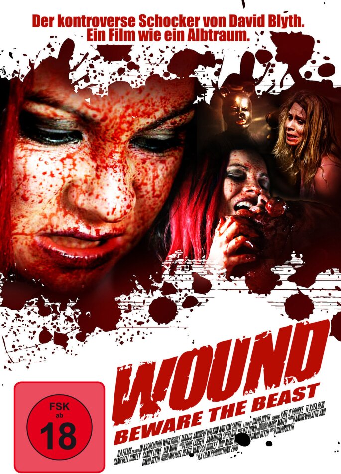 Wound