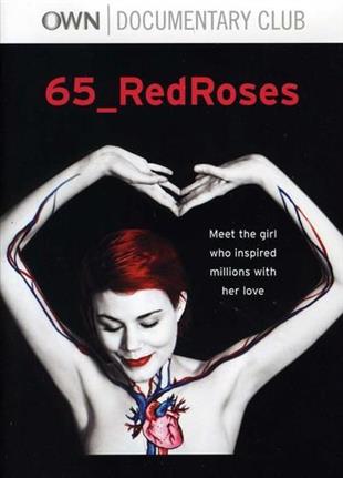 65_RedRoses
