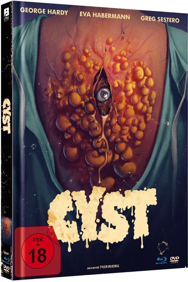 Cyst (2020) Limited Edition, Mediabook, Special Edition, Uncut, Blu-ray + DVD