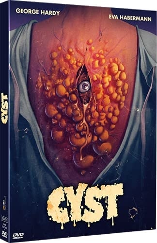 Cyst (2020)